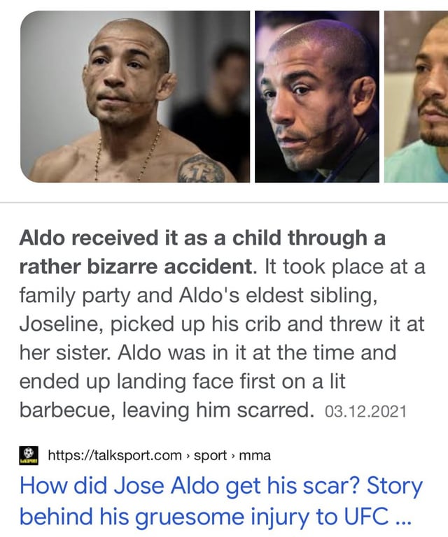 how did jose aldo get that scar on his face