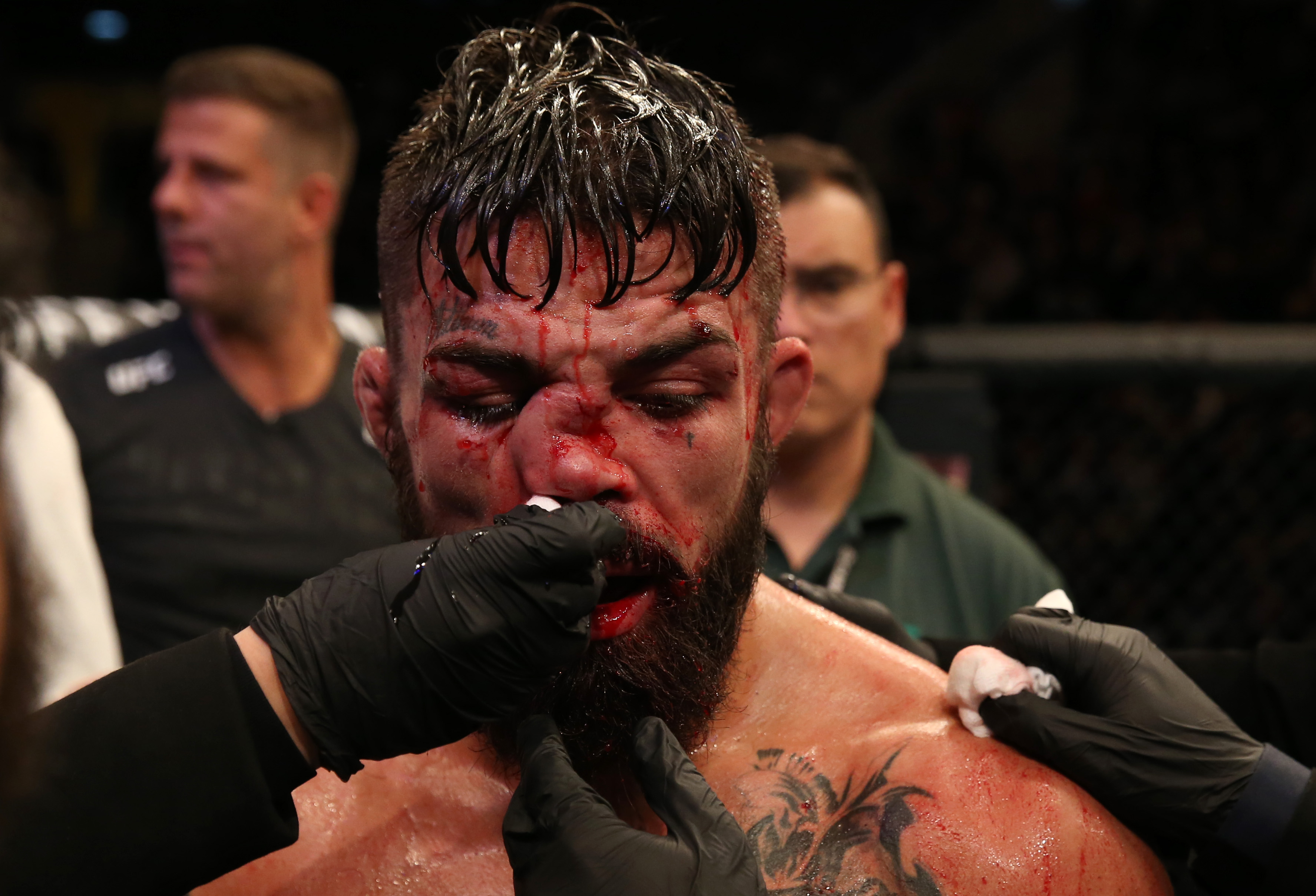 Shocking! Mike Perry Suffers Broken Nose in Brutal Match