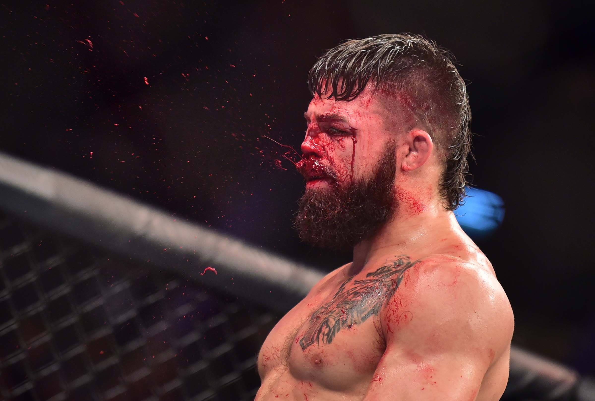 Shocking! Mike Perry Suffers Broken Nose in Brutal Match