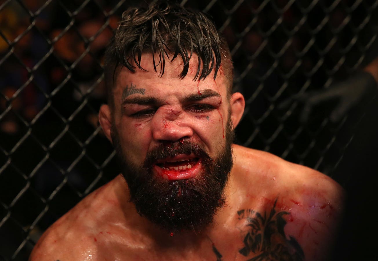 Shocking! Mike Perry Suffers Broken Nose in Brutal Match