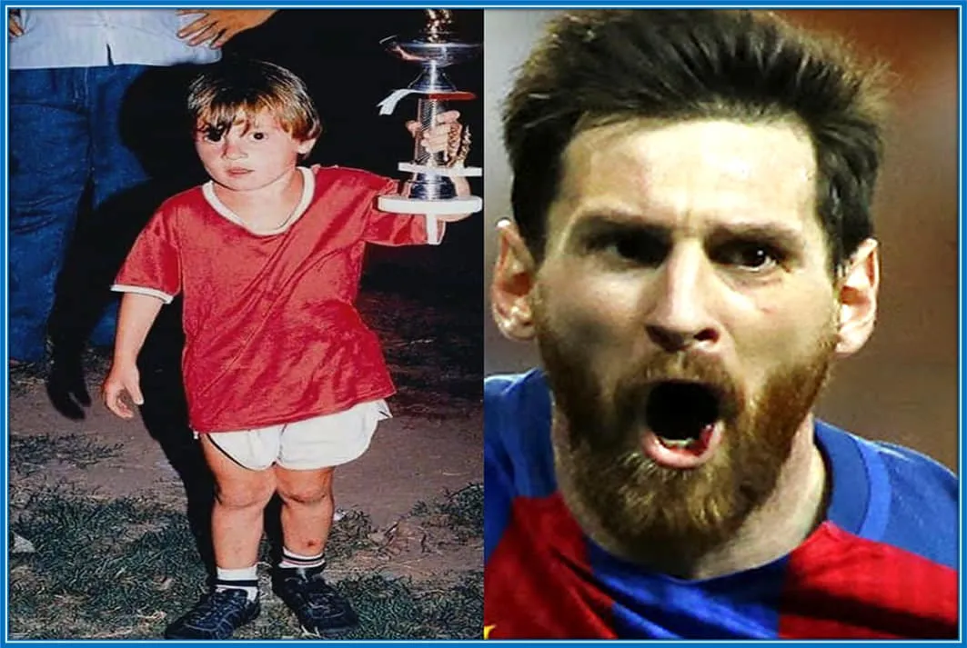 Messi Down Syndrome: Whats the Real Story? Get the Facts Here!