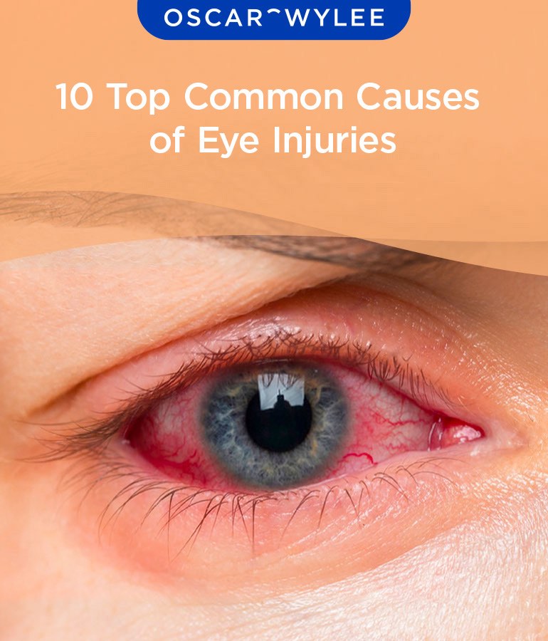 Tonga Loa Eye Injury: Common Causes and Easy Treatments.